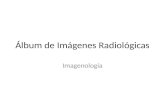 Álbum de Imágenes Radiológicas de Tubo Digestivo