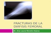Fracturas De La Diáfisis Femoral