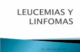 Leucemias y linfomas