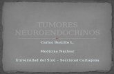 Tumores neuroendocrinos
