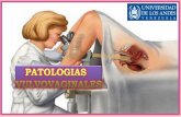 Patologias de vulva