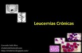 Leucemias cr³nicas