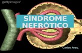 Sindrome nefrotico nefritico