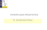 HIPERPLASIA PROSTATICA Dr. Gonzalo Azúa Córdova. Próstata Tejido Glandular Zona Central Zona Periférica Zona de Transición (Hiperplasia)