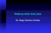 PARALISIS FACIAL Dr. Hugo Hawkins Peralta.. La paralisis del VII par craneal constituye la lesion nerviosa periferica mas frecuente posiblemente por su.