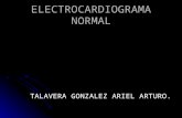 ELECTROCARDIOGRAMA NORMAL TALAVERA GONZALEZ ARIEL ARTURO.