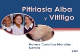 Tosferina Norma Carolina Morales García Z02. PITIRIASIS ALBA Sinónimos y Definición Epidemiología Etiopatogenia Cuadro clínico Tratamiento VITILIGO Sinónimos.