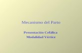 Mecanismo del Parto Presentación Cefálica Modalidad Vértice.