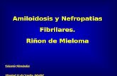 Amiloidosis y Nefropatias Fibrilares. Riñon de Mieloma Eduardo Hernández Hospital 12 de Octubre. Madrid.