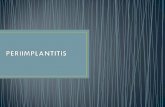 La periimplantitis es la lesion que involucra a los tejidos blandos y porcion marginal de la interfase implante-hueso; esto en otras palabras se puede.