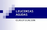 LEUCEMIAS AGUDAS CLASIFICACION. LEUCEMIA AGUDA La Leucemia es un padecimiento neoplásico que se origina en células hematopoyéticas de la médula ósea.