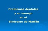 Problemas dentales y su manejo en el Síndrome de Marfán.