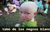 El tabú de los negros blancos Albinismo, del latín albus, que significa blanco, es una condición genética hereditaria, caracterizada por la ausencia.