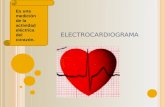 ELECTROCARDIOGRAMA Es una medición de la actividad eléctrica del corazón.