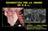DIAGNOSTICO POR LA IMAGEN EN O.R.L. Manuel J. Ramos Gómez Neurorradiología Hospital Reina Sofía.