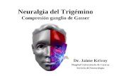 Neuralgia del Trigémino Compresión ganglio de Gasser Dr. Jaime Krivoy Hospital Universitario de Caracas Servicio de Neurocirugía.