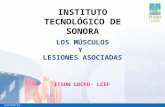 LOS MÚSCULOS Y LESIONES ASOCIADAS ITSON LDCFD- LCEF INSTITUTO TECNOLÓGICO DE SONORA.