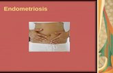 Endometriosis. La endometriosis es un crecimiento anormal de tejido. Desde el punto de vista histológico semeja al endometrio, pero fuera de este.