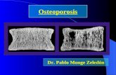 Osteoporosis Dr. Pablo Monge Zeledón. Unidad de remodelación ósea en un adulto.