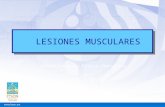 Rehabilitación Física Deportiva LESIONES MUSCULARES.