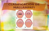 Clasificacion de Mallampati