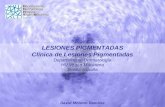 LESIONES PIGMENTADAS Clínica de Lesiones Pigmentadas Departamento Dermatología HU Virgen Macarena Sevilla-España David Moreno Ramírez.