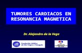 TUMORES CARDIACOS EN RESONANCIA MAGNETICA Dr. Alejandro de la Vega.