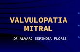 VALVULOPATIA MITRAL DR ALVARO ESPINOZA FLORES. ANATOMIA VALVULAR.