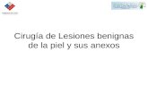 Cirugía de Lesiones benignas de la piel y sus anexos.