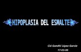 Cid Gandhi López García 17-03-06. Es una patología que altera la mineralización de la estructura del esmalte y es totalmente adquirida.