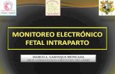 5 Monitoreo Electronico Fetal