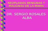 NEOPLASIAS BENIGNAS Y MALIGNAS DE LA MAMA DR. SERGIO ROSALES ALBA.