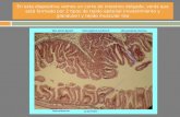 En esta diapositiva vemos un corte de intestino delgado, verás que está formado por 2 tipos de tejido epitelial (revestimiento y glandular) y tejido muscular.