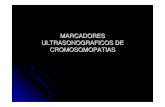 Marcadores ultrasonograficos de cromosomopatias