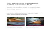 Artrodesis subastragalina o fusion de articulaciones del pie