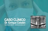 Caso Clínico C090413 - Dr. Enrique Catalán Bajuelo
