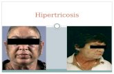Hipertricosis, un problema peludo   ateneo (1)