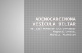 Adenocarcinoma vesícula biliar