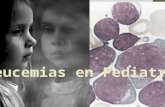 Linfomas y Leucemias en Pediatr­a
