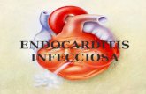 Endocarditis fisiopatologia
