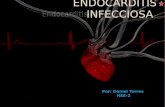 Endocarditis cardiología