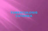 Tuberculosis cutanea expo