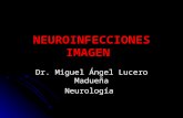 Neuroinfecciones imagen