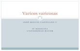 Varices varicosas