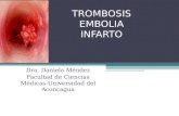 Tromboembolismo e infarto