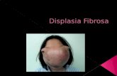Displasia fibrosa