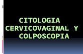 Citologia y colposcopia  patologia maligna de cervix