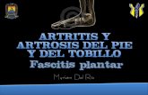 Artrosis del pie y del tobillo, fascitis plantar