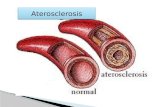 Aterosclerosis diapositivas