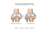 Osteoartritis nuevo tema